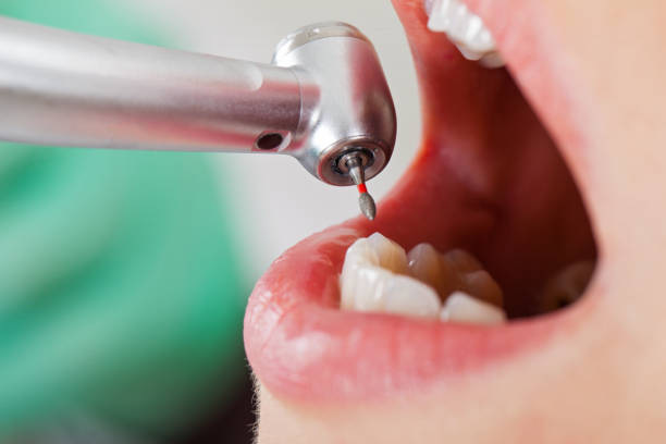 Best Tooth Pain Emergency Relief  in Stepping Stone, CO